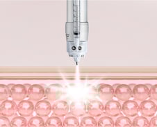 피부 안 찔러도 주름 지운다? "바늘 없는 필러주사가 더 효과적"