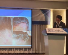 "피 흘릴 정도로 박박" 극심한 가려움…'건선' 중증도 기준 달라진다