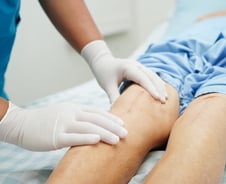 자가 연골 이식에서 줄기세포 주사까지…'인공관절' 최대한 늦추려면