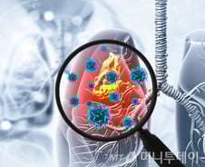 폐암보다 무섭다…"기침·열도 없는데 폐렴" 노인에 치명적