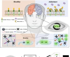 눈에 넣으면 치매인지 알려준다? 인공수정체 형광 센서, 한국서 개발