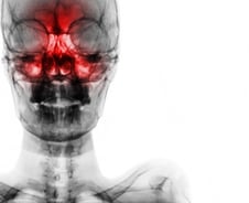 "약발 안 듣는" 알레르기 비염, '코 수술' 효과 몇 년 가나 봤더니