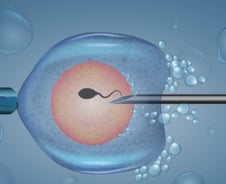 무정자증 남편, 이 시술 했더니 '아빠' 됐다…5년새 12배 '급증'