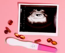 '낙태죄' 시대, 67년 만에 끝…처벌 못하지만 혼란 계속[뉴스속오늘]