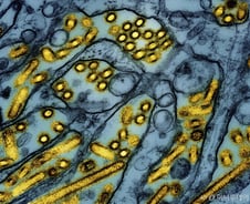 "잘 알려지지 않은 바이러스" 중국서 또 감염병이…미국도 심상찮다
