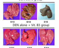 "간에서 암세포 싹 사라져" 비타민B3 권위자, 환호한 이유