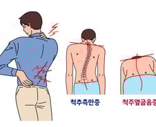"5㎝ 더 커질 수 있어요"…겨울 방학 숨은 키 찾는 법