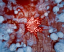 "밖에서 운동했을 뿐인데" 피부암 충격…1급 발암물질 '이것' 때문