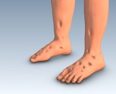 "베개 몇 개 더" 부모님 이 말, 심장이 보내는 SOS?…사망 부르는 이 병