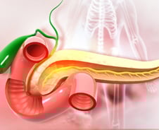 발견해도 80% '수술 불가'…간암서 성과 낸 치료법, 췌장암에도 효과?
