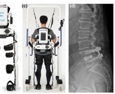 재활로봇 큰 효과 "일상생활 능력 39% 향상…낙상 공포 없어 만족"