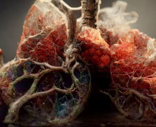 레이저티닙·아미반타맙 병용, 비정형 EGFR 폐암에 치료 효과 '우월'