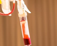 전공의 떠난 직후 수혈 2만2000건 뚝…상급종합병원 환자 피해 더 컸다