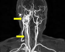 "귀에서 이런 소리가 들려"…심혈관·자궁 빨간불 신호?