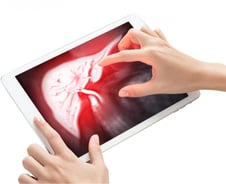 간 초음파 꼬박꼬박해도 30% "암 치료 불가"…조기 진단, '이 검사'로 해결