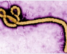 "완치" 안심? 정액서 18개월 살아남는다…치사율 60% '이 병'