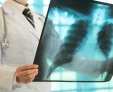 "빨리 낫고 싶어" 병원 계속 옮기면서 '엑스레이' 찍었다간…의사의 경고