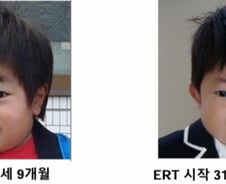 "유치원생이 틀니를" 진단 늦으면 '사망' 이 병…한국은 뒷걸음?