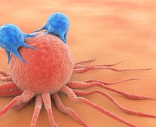 "붉은 고기 끊고 채소만 먹어" 그래도 걸린다…5대 암 똑똑하게 막으려면