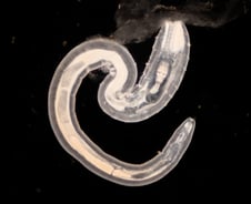 "싱싱할 때 먹어야지"…민물고기 잘 못 먹었다간 '담도암'까지?