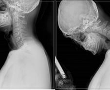 당신의 목 사진은 왼쪽? 오른쪽?…스마트폰 자주 봤더니