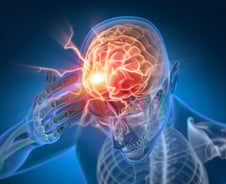 "뇌진탕 1년 지났는데 이럴 수가"…'이 병' 위험 2배 이상 높았다