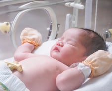 "희귀병 찾는 신생아 유전체 검사, 국가가 주도해야" 의사 강력권고, 왜