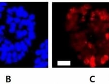 두경부암 발생 이끈 돌연변이 유전자, 한국 의료진이 찾았다