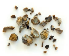 "지금이야" 확 늘어난 야외활동…여름 아니라고 방심했다간