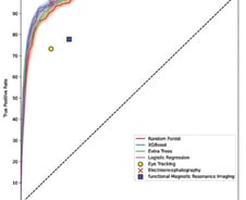 눈만 보고 'ADHD' 알아낸다…'정확도 97%' AI 개발