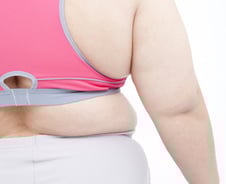 유방암 환자, 체중 10% 늘면 뇌졸중 83%·심부전 85% 위험 증가