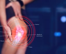 "무릎뼈 어긋날 조짐 보여요" 이런 경종 울리는 AI, 한국서 나왔다