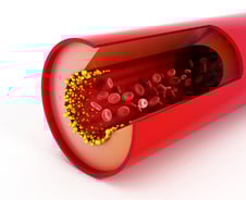 만성 간질환자 먹지 말라더니…오히려 간암 막아준 '고지혈증 치료제'