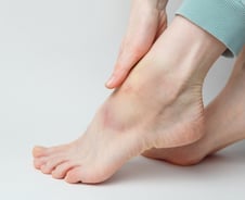 "발목 삔 후 자꾸 꺾이고, 발 힘 풀려" 이런 사람, 발 찜질만으론 안 돼요