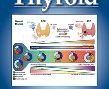 착한 암? NO!…韓 연구진, '나쁜 갑상선암' 치료 실마리 찾았다