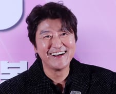 송강호 달라진 얼굴에 깜짝…"생기 되찾아" 이 성형술 효과 높이려면?