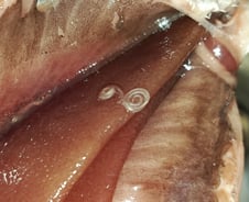 "왜 유독 한국인만"…췌장암보다 예후 더 나쁜 이 암, 환자 느는 이유