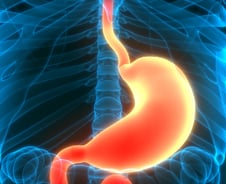 "위암 수술 후 통증 줄었다"…환자들 빨리 회복, 퇴원 당긴 비결