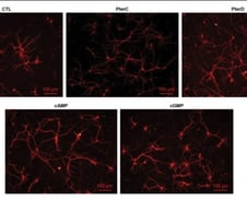 치매 치료 새길 열리나…"부작용 적고 기억력 되살리는 물질 발견"