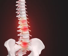 척추 수술했는데 계속되는 통증…"아프다고 다 치료하면 안돼" 의사 조언