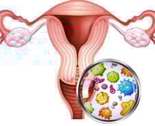 "유해균 유독 많아"…당뇨병 여성 환자, 몸 '이곳' 관리도 필수