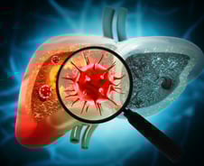 간암 76% 없앨 수 있다…백신·치료제 다 있는 '이 병' 관리 시급