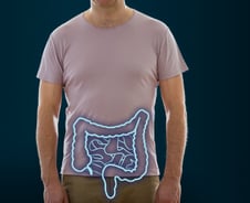 말기 대장암 환자, 수술 vs 항암…5년 생존율 '이것' 더 높았다