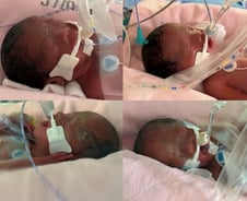 아들3 딸1 '네 쌍둥이 출산기'…쏟아진 축하인사 "아파트 한채 줘야"[오따뉴]