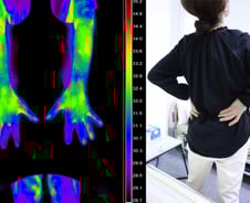 "이 더위에 손발 시려?"…허리까지 쑤신다면 단순 냉증 아닙니다