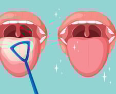 "입냄새 나나?" 칫솔로 혀 벅벅…어쩐지 효과 없던 이유[한 장으로 보는 건강]