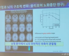 "보청기? 난 그 정도 아냐" 난청 노인 87% '방치'…치매도 부른다