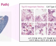 암·알츠하이머도 정복?…'인류의 숙원' AI로 잡는다