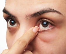 "또 코피 터졌다" 요즘 피곤한가 했는데…날씨 때문? '건조증' 주의보