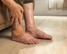 다리 퉁퉁, 밤마다 화장실 들락날락 부모님…알고보니 심장이 보낸 경고